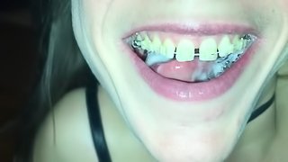 Cum play with retainer.