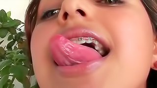 Braces teen smokes cigarette