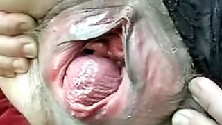 Close Up Video of a Mature Lady's Prolapsing Pussy